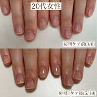 画像1316：20代女性
