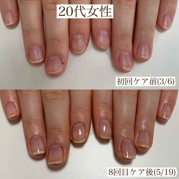 画像1316：20代女性